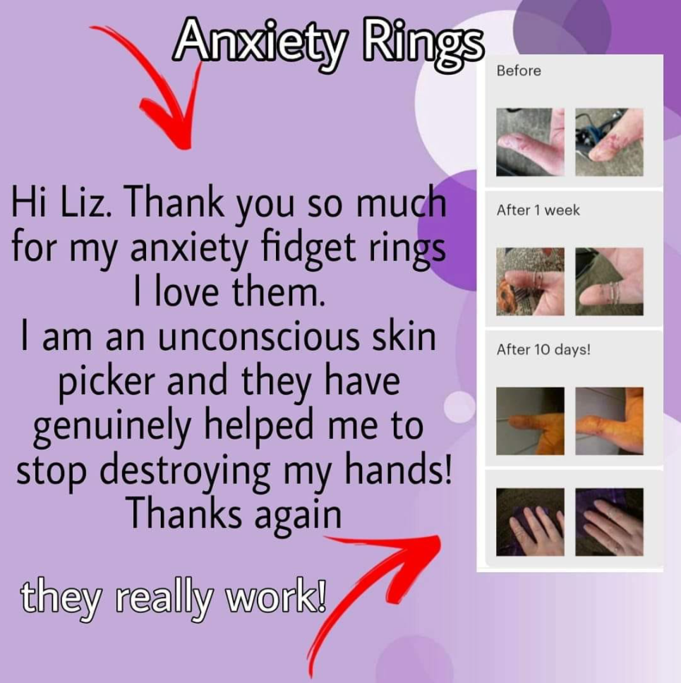Anxiety rings can help reduce stress